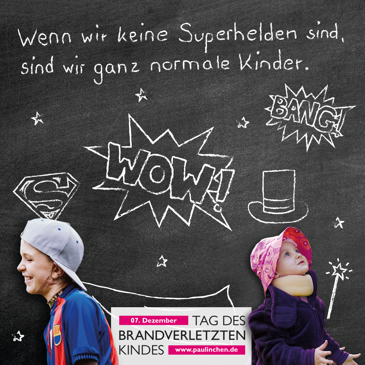 Verbrennungen und Verbrühungen bei Kindern